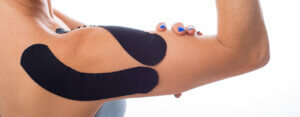 Kinesio Taping Burlingame, CA